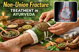 Non-Union Fracture Treatment in Ayurveda